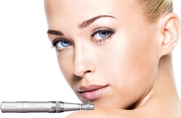 Why We’re Obsessed With The Micropen Treatment