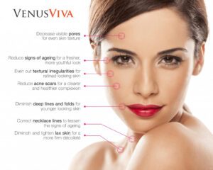 laser skin resurfacing with venus viva