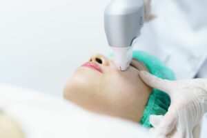 Mara - laser treatments for rosacea during treatment