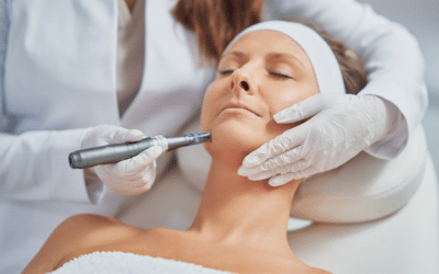 The Beauty Revolution: Microneedling In Dallas Takes Center Stage