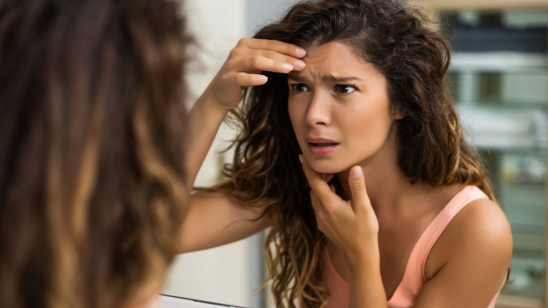 Mara - chemical peel treatments in Dallas
