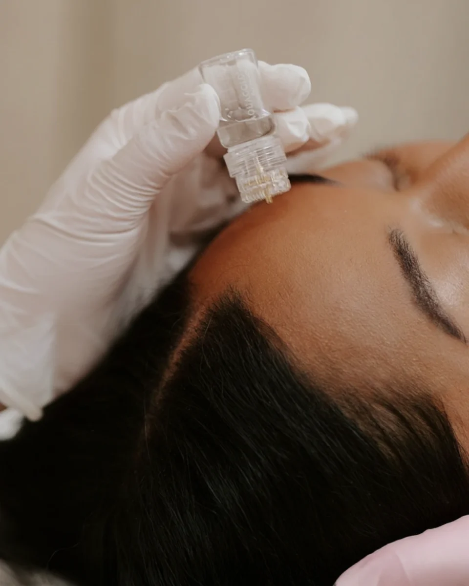 ASCE+ Exosomes regenerative treatment to boost repair and glow in Dallas