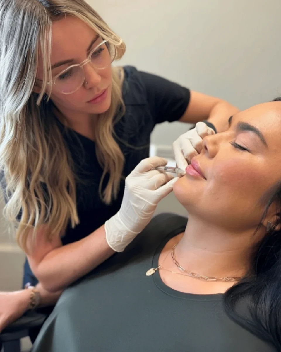 Juvéderm Ultra Plus XC filler for added lift in folds and lines in Dallas