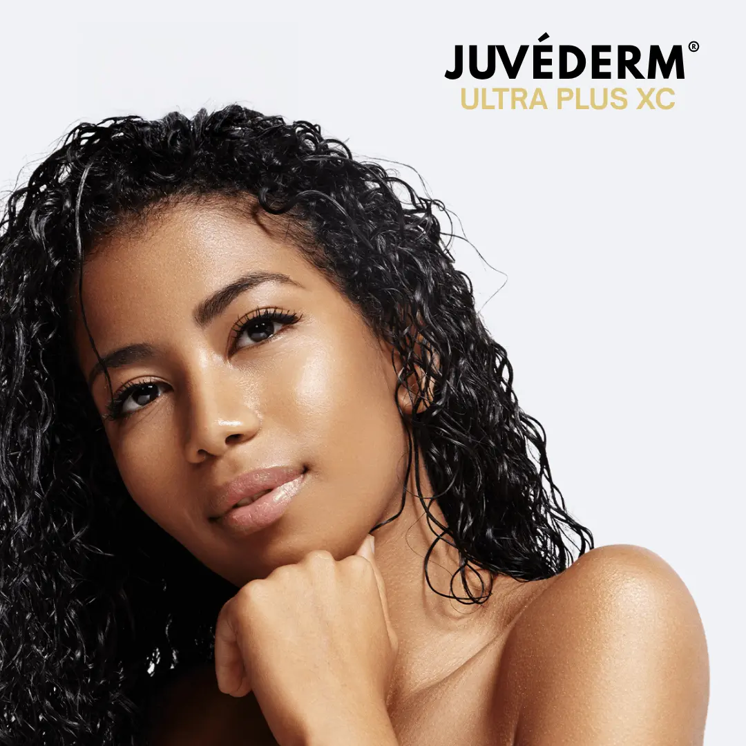 Juvéderm Ultra Plus XC lip filler