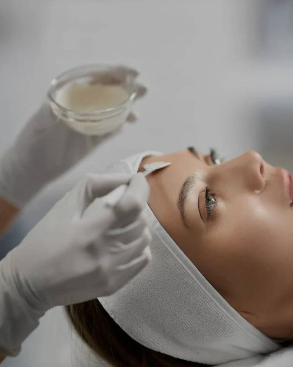 Renew 30 Peel gentle resurfacing for refreshed skin in Dallas