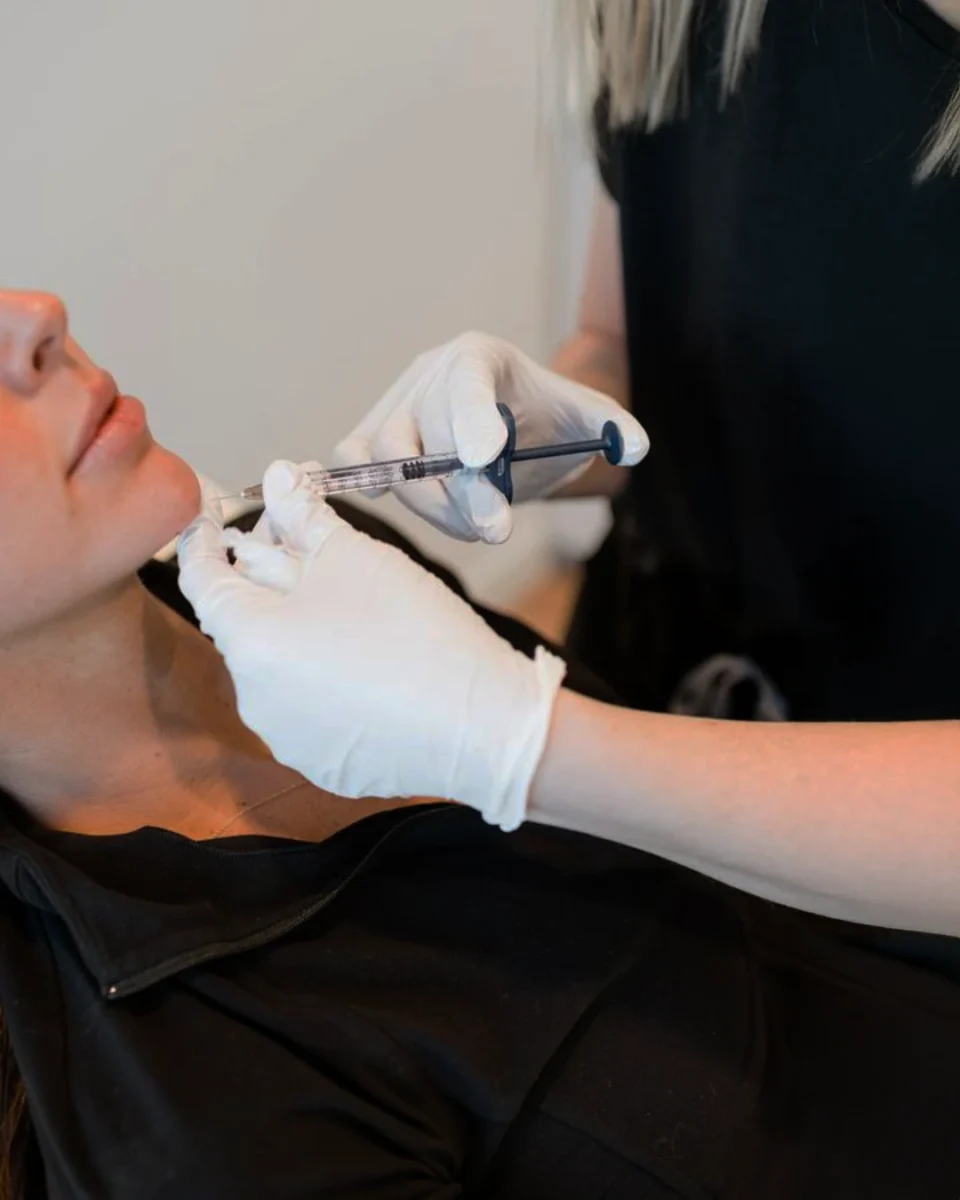 Restylane Defyne filler for deeper lines with natural movement in Dallas