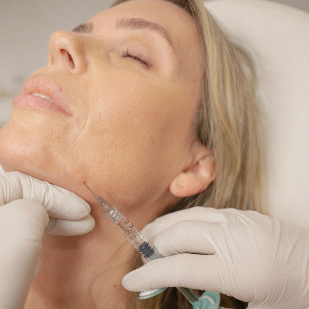 Contour and Define jawline and cheek results