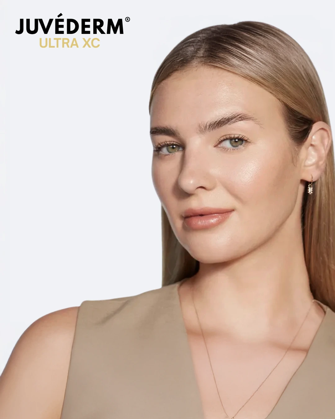 Juvéderm Ultra XC for lip fillers in Dallas