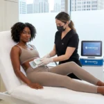 CoolSculpting Dallas treatment image for CoolSculpting Elite at Mara's Med Spa in Dallas
